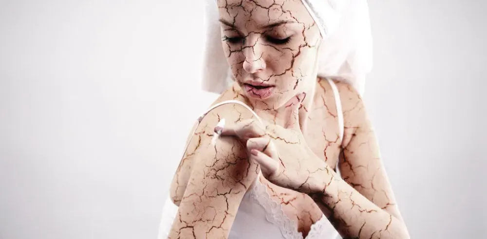 "Understanding and Managing Dry Skin: A Comprehensive Guide"